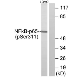 Western Blot - Anti-NF-kappaB p65 (phospho Ser311) Antibody (A7163) - Antibodies.com