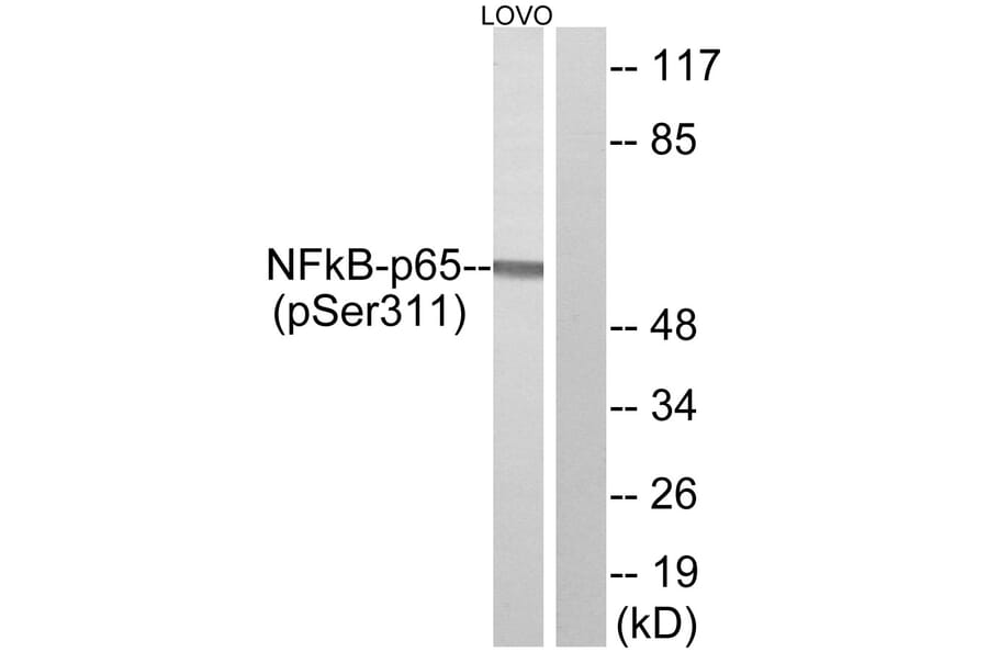 Western Blot - Anti-NF-kappaB p65 (phospho Ser311) Antibody (A7163) - Antibodies.com