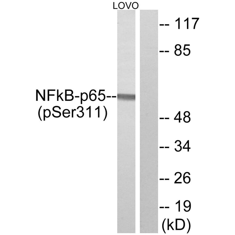 Western Blot - Anti-NF-kappaB p65 (phospho Ser311) Antibody (A7163) - Antibodies.com