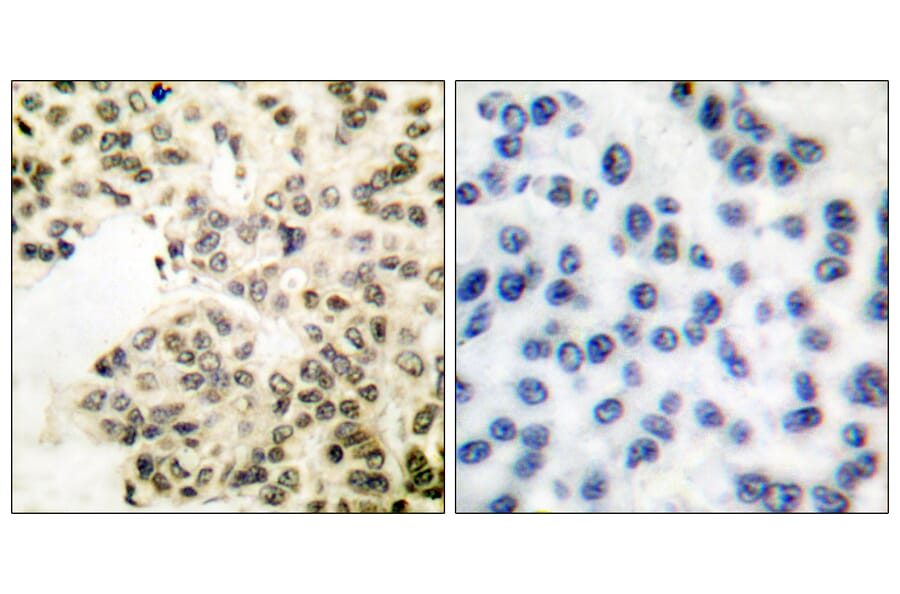 Immunohistochemistry - Anti-NF-kappaB p65 (phospho Ser311) Antibody (A7163) - Antibodies.com
