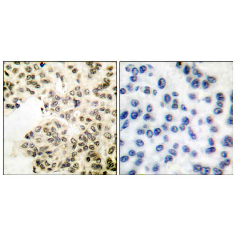 Immunohistochemistry - Anti-NF-kappaB p65 (phospho Ser311) Antibody (A7163) - Antibodies.com