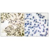 Immunohistochemistry - Anti-NF-kappaB p65 (phospho Ser311) Antibody (A7163) - Antibodies.com