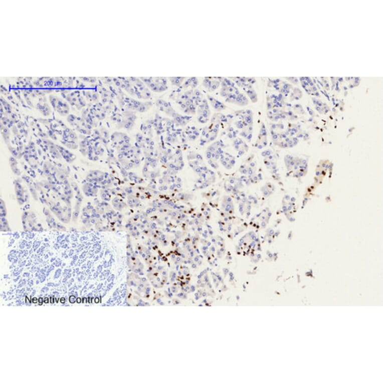 Immunohistochemistry - Anti-Histone H2A.X (phospho Ser139) Antibody (A7106) - Antibodies.com