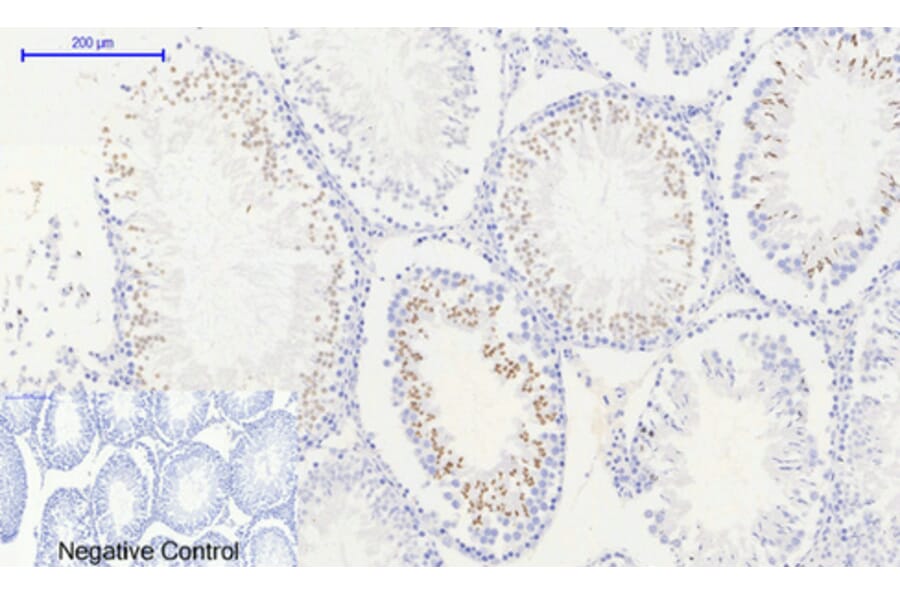 Immunohistochemistry - Anti-Histone H2A.X (phospho Ser139) Antibody (A7106) - Antibodies.com