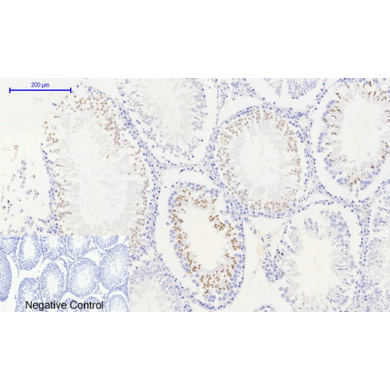Immunohistochemistry - Anti-Histone H2A.X (phospho Ser139) Antibody (A7106) - Antibodies.com