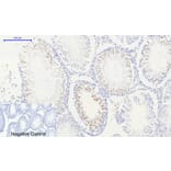 Immunohistochemistry - Anti-Histone H2A.X (phospho Ser139) Antibody (A7106) - Antibodies.com