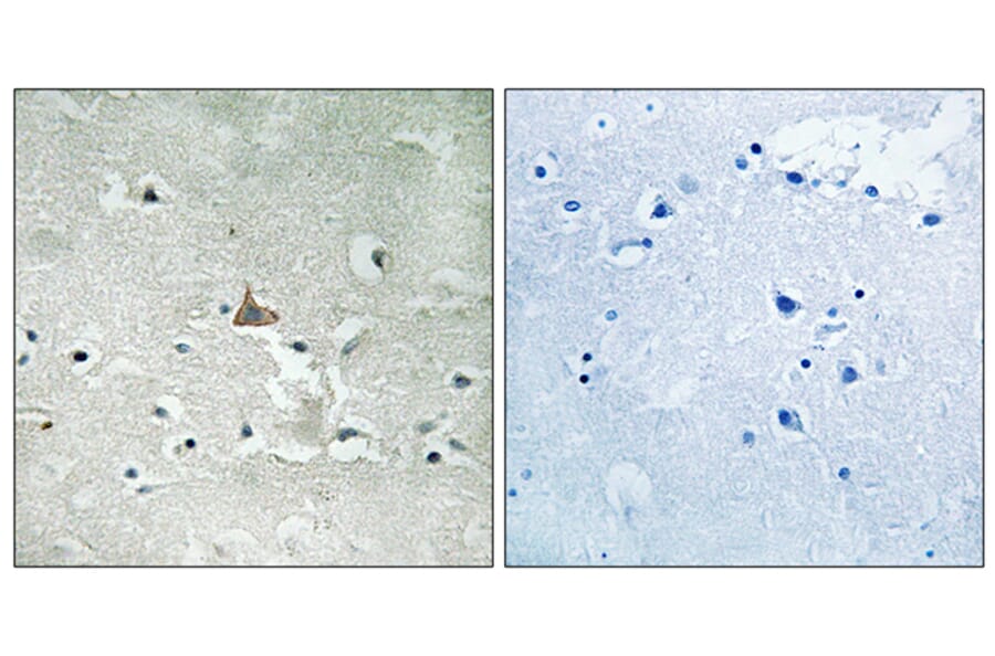 Immunohistochemistry - Anti-Trk B (phospho Tyr706+Tyr707) Antibody (A8195) - Antibodies.com
