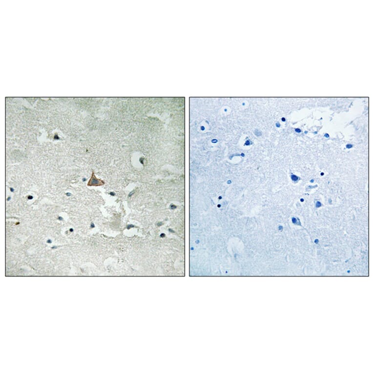 Immunohistochemistry - Anti-Trk B (phospho Tyr706+Tyr707) Antibody (A8195) - Antibodies.com