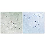 Immunohistochemistry - Anti-Trk B (phospho Tyr706+Tyr707) Antibody (A8195) - Antibodies.com