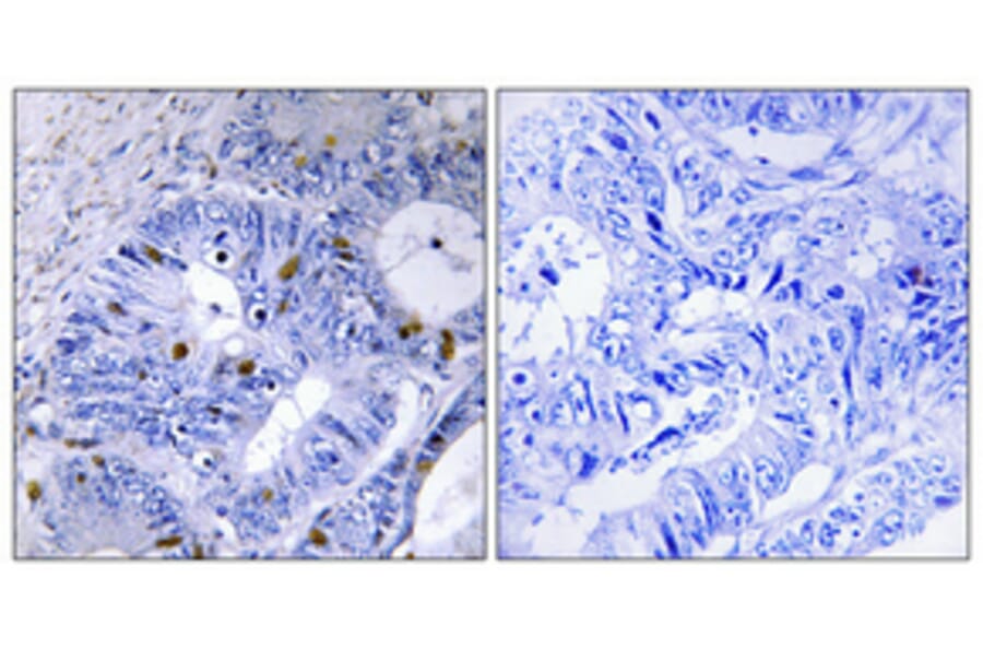 Immunohistochemistry - Anti-Presenilin 2 (phospho Ser330) Antibody (A1227) - Antibodies.com