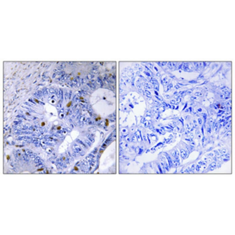 Immunohistochemistry - Anti-Presenilin 2 (phospho Ser330) Antibody (A1227) - Antibodies.com