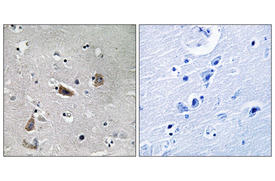 Immunohistochemistry - Anti-Doublecortin (phospho Ser376) Antibody (A8337) - Antibodies.com