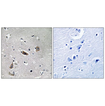 Immunohistochemistry - Anti-Doublecortin (phospho Ser376) Antibody (A8337) - Antibodies.com