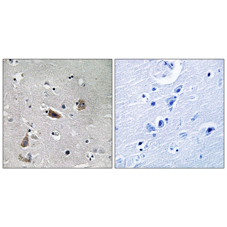 Immunohistochemistry - Anti-Doublecortin (phospho Ser376) Antibody (A8337) - Antibodies.com