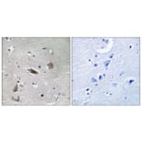 Immunohistochemistry - Anti-Doublecortin (phospho Ser376) Antibody (A8337) - Antibodies.com