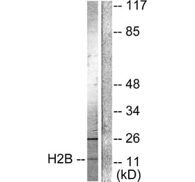 Western Blot - Anti-Histone H2B (acetyl Lys15) Antibody (D0005) - Antibodies.com