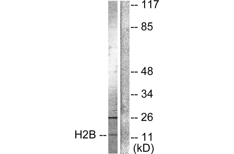 Western Blot - Anti-Histone H2B (acetyl Lys15) Antibody (D0005) - Antibodies.com