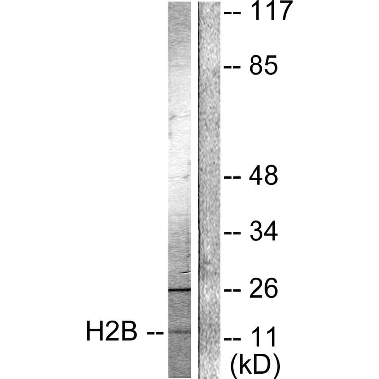 Western Blot - Anti-Histone H2B (acetyl Lys15) Antibody (D0005) - Antibodies.com