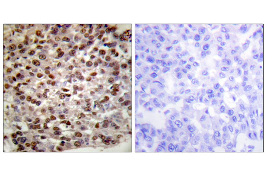 Immunohistochemistry - Anti-Histone H2B (acetyl Lys15) Antibody (D0005) - Antibodies.com
