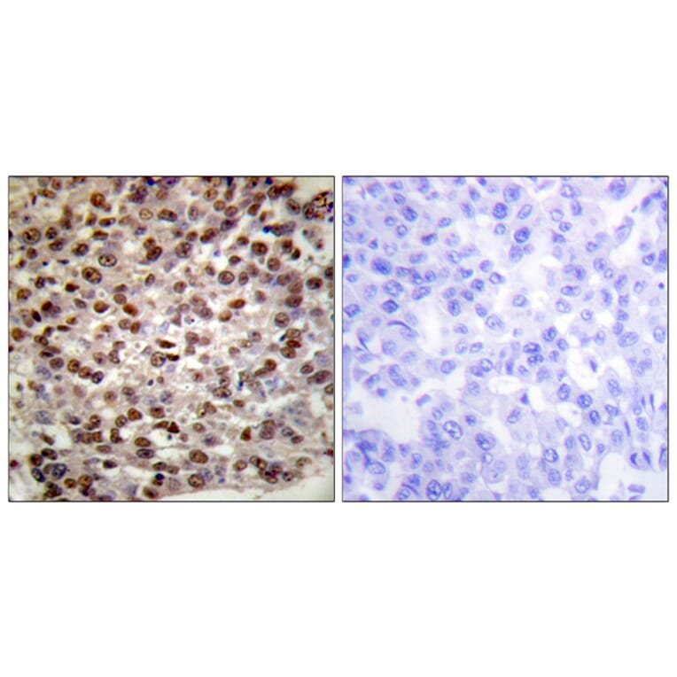 Immunohistochemistry - Anti-Histone H2B (acetyl Lys15) Antibody (D0005) - Antibodies.com