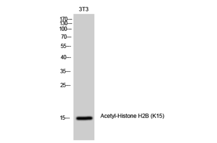 Western Blot - Anti-Histone H2B (acetyl Lys15) Antibody (D0005) - Antibodies.com