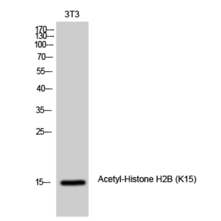 Western Blot - Anti-Histone H2B (acetyl Lys15) Antibody (D0005) - Antibodies.com