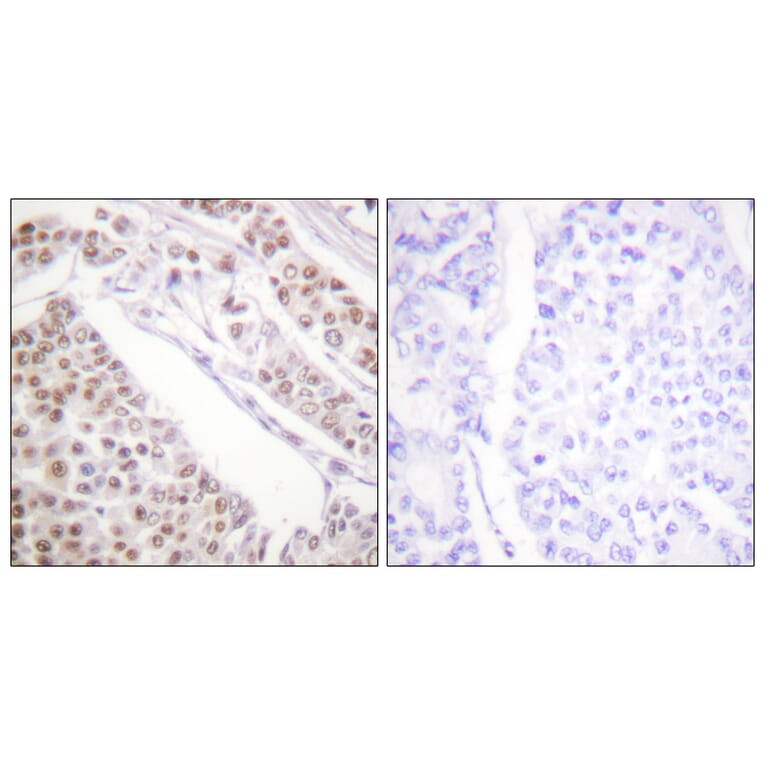 Immunohistochemistry - Anti-Histone H2B (acetyl Lys12) Antibody (D0004) - Antibodies.com