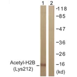 Western Blot - Anti-Histone H2B (acetyl Lys12) Antibody (D0004) - Antibodies.com