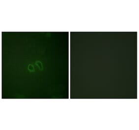 Immunofluorescence - Anti-Vinculin (phospho Tyr821) Antibody (A1017) - Antibodies.com