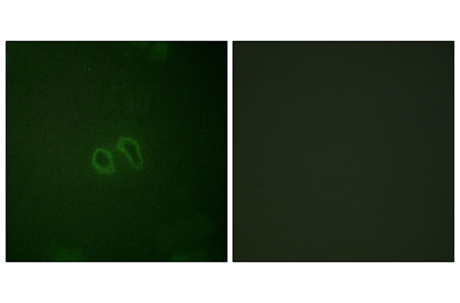 Immunofluorescence - Anti-Vinculin (phospho Tyr821) Antibody (A1017) - Antibodies.com