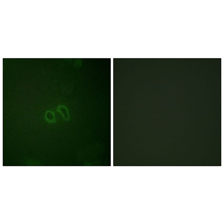 Immunofluorescence - Anti-Vinculin (phospho Tyr821) Antibody (A1017) - Antibodies.com