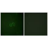 Immunofluorescence - Anti-Vinculin (phospho Tyr821) Antibody (A1017) - Antibodies.com