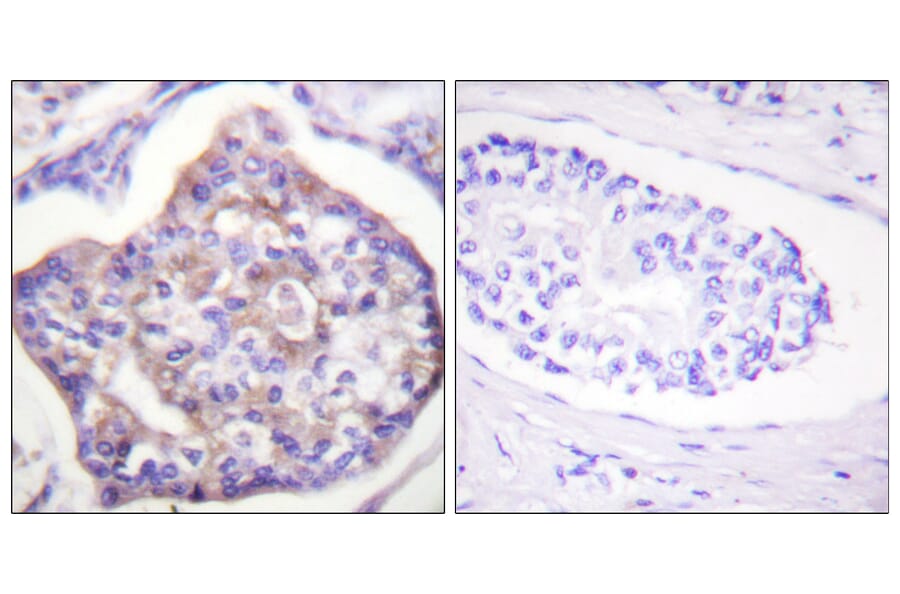 Immunohistochemistry - Anti-Vinculin (phospho Tyr821) Antibody (A1017) - Antibodies.com