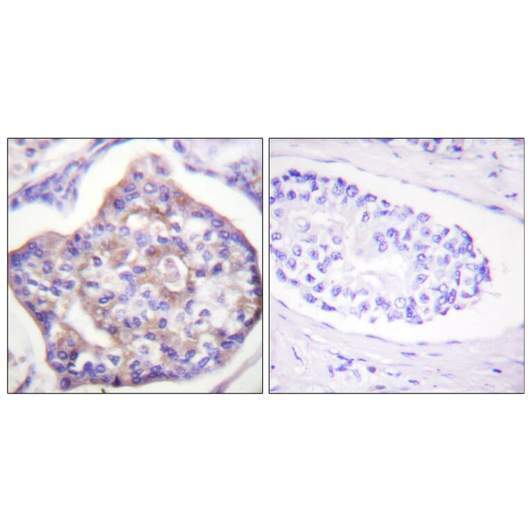 Immunohistochemistry - Anti-Vinculin (phospho Tyr821) Antibody (A1017) - Antibodies.com