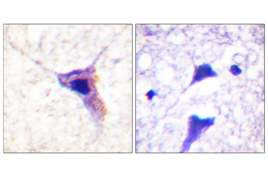 Immunohistochemistry - Anti-Synapsin1 (phospho Ser62) Antibody (A0581) - Antibodies.com