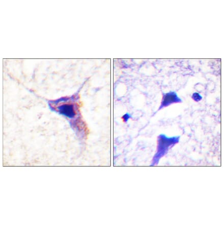 Immunohistochemistry - Anti-Synapsin1 (phospho Ser62) Antibody (A0581) - Antibodies.com