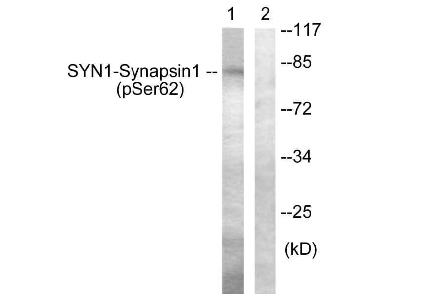 Western Blot - Anti-Synapsin1 (phospho Ser62) Antibody (A0581) - Antibodies.com