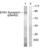 Western Blot - Anti-Synapsin1 (phospho Ser62) Antibody (A0581) - Antibodies.com