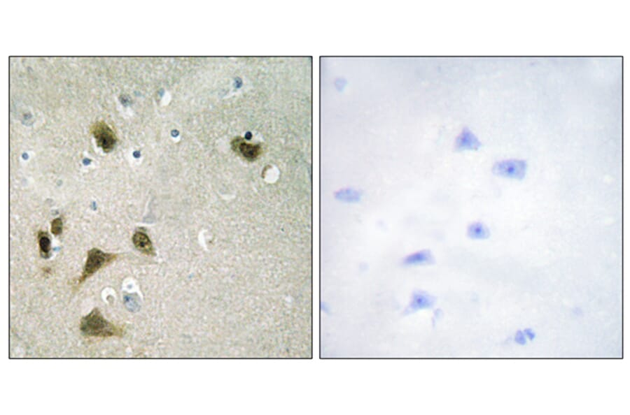 Immunohistochemistry - Anti-Survivin (phospho Thr117) Antibody (A0579) - Antibodies.com