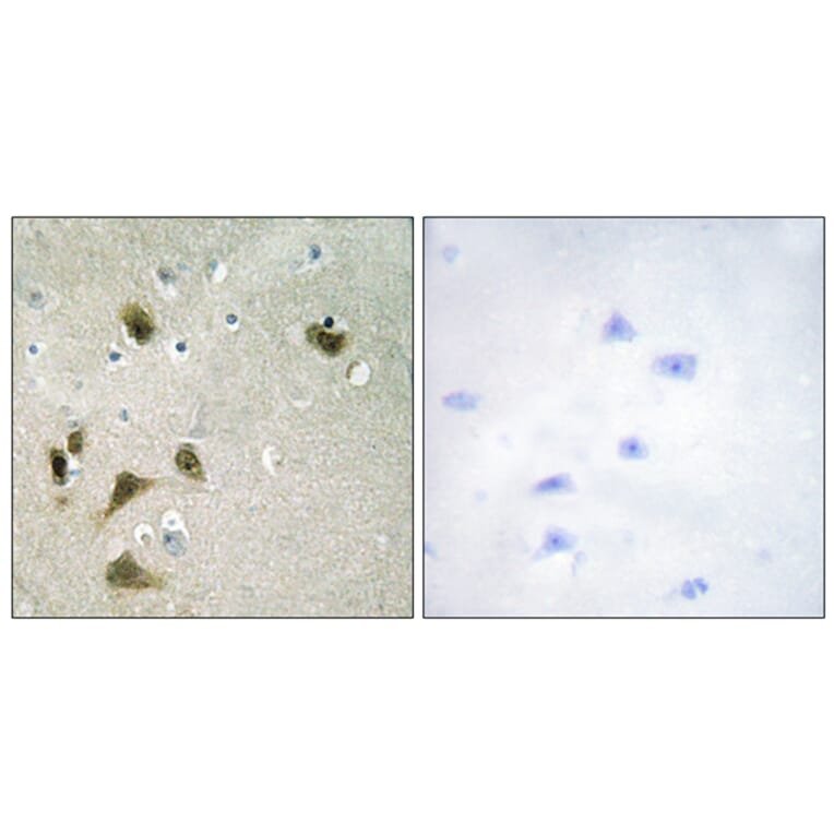 Immunohistochemistry - Anti-Survivin (phospho Thr117) Antibody (A0579) - Antibodies.com