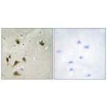 Immunohistochemistry - Anti-Survivin (phospho Thr117) Antibody (A0579) - Antibodies.com