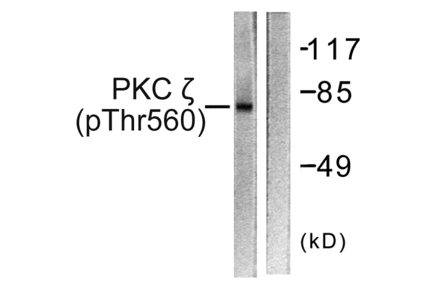 Western Blot - Anti-PKC zeta (phospho Thr560) Antibody (A0805) - Antibodies.com