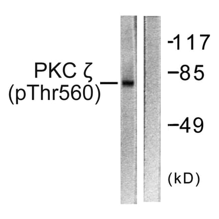 Western Blot - Anti-PKC zeta (phospho Thr560) Antibody (A0805) - Antibodies.com