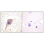 Immunohistochemistry - Anti-PKC zeta (phospho Thr560) Antibody (A0805) - Antibodies.com