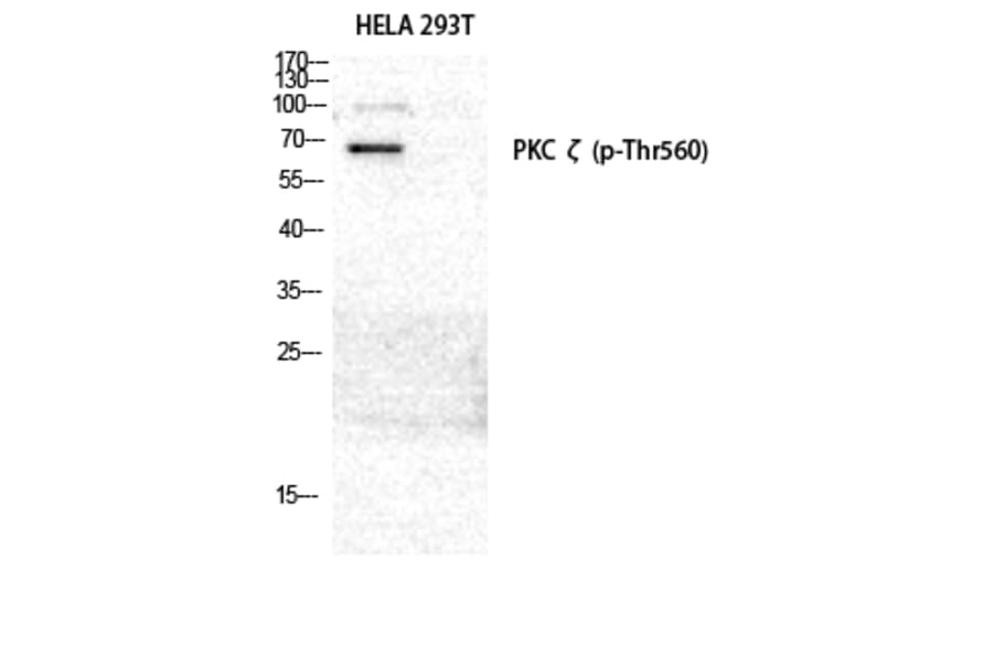 Western Blot - Anti-PKC zeta (phospho Thr560) Antibody (A0805) - Antibodies.com