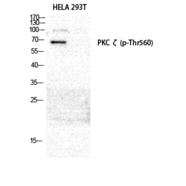Western Blot - Anti-PKC zeta (phospho Thr560) Antibody (A0805) - Antibodies.com