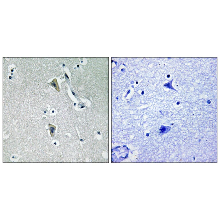 Immunohistochemistry - Anti-PKC thet (phospho Thr538) Antibody (A0719) - Antibodies.com