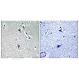 Immunohistochemistry - Anti-PKC thet (phospho Thr538) Antibody (A0719) - Antibodies.com
