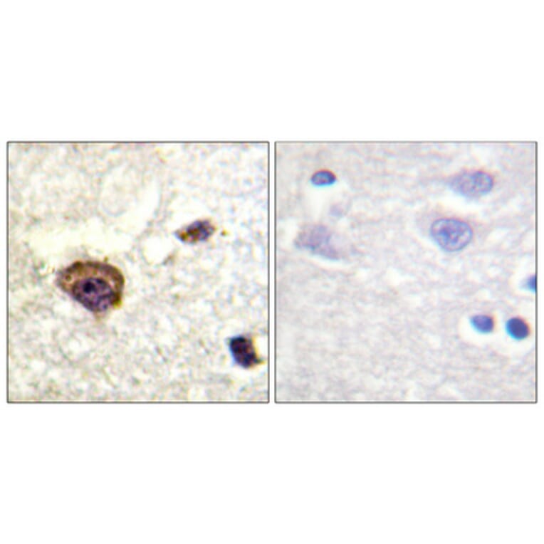 Immunohistochemistry - Anti-PKC thet (phospho Thr538) Antibody (A0719) - Antibodies.com
