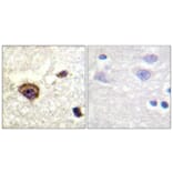 Immunohistochemistry - Anti-PKC thet (phospho Thr538) Antibody (A0719) - Antibodies.com